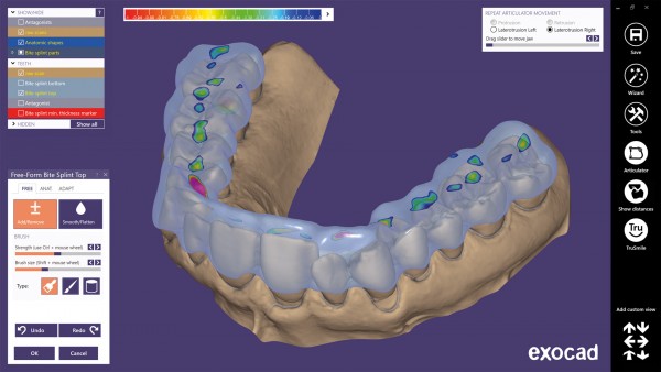 bite-splint-module_screenshot01_600x600.jpg